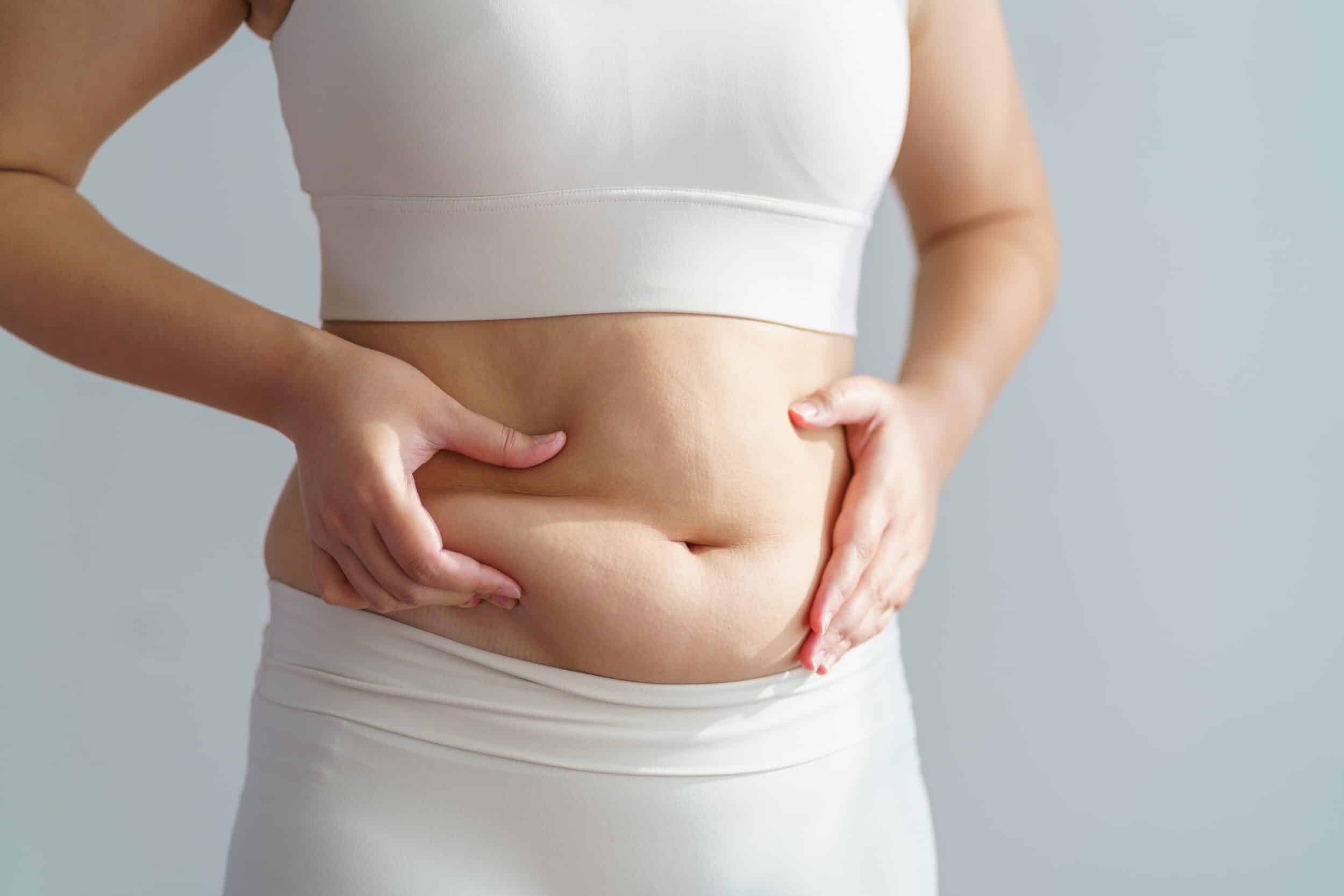 Can You Get Abdominal Liposuction After a Tummy Tuck?