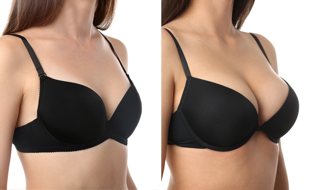 how to fix sagging breasts