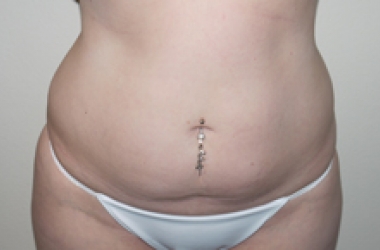 Before Image