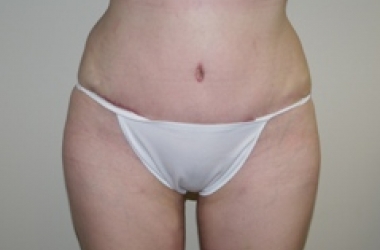 After Image