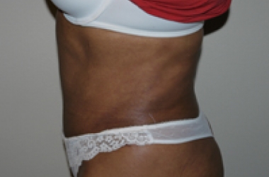 After Image