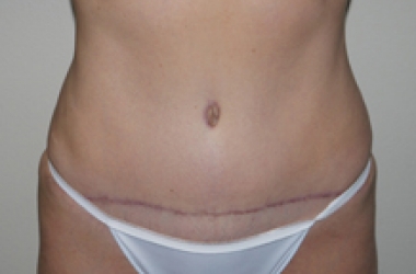 After Image