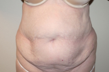 Before Image