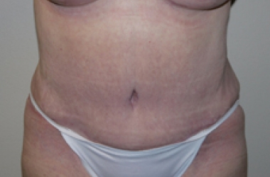 After Image