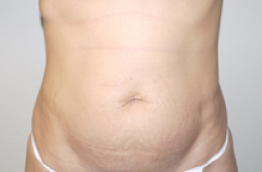 Before Image