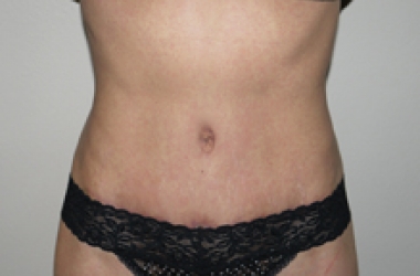After Image