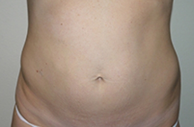 Before Image