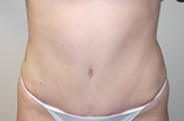After Image