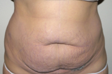 Before Image