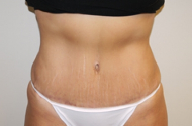 After Image