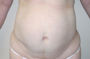 Before Image