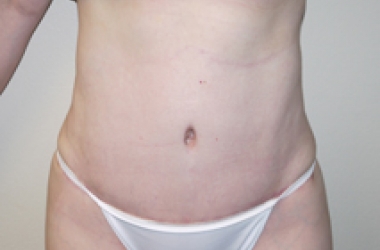 After Image