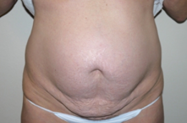 Before Image