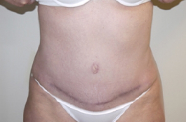 After Image