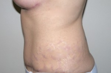 After Image