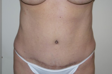 After Image