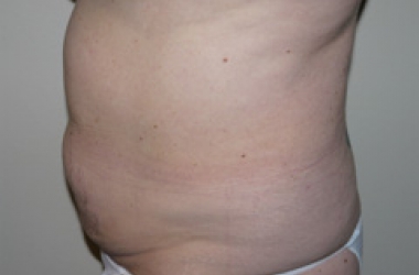 After Image