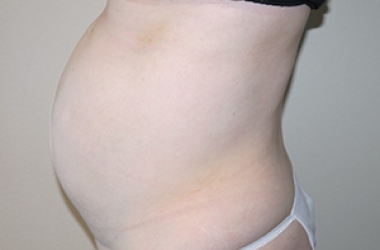 Before Image