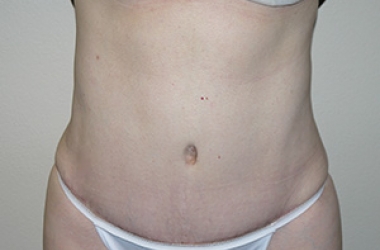 After Image