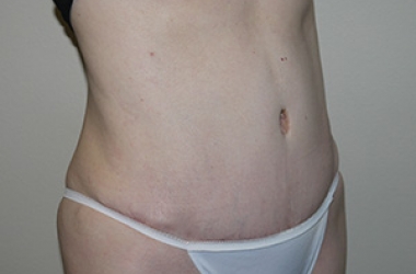 After Image