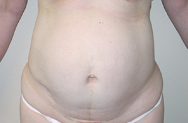 Before Image