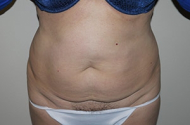 Before Image