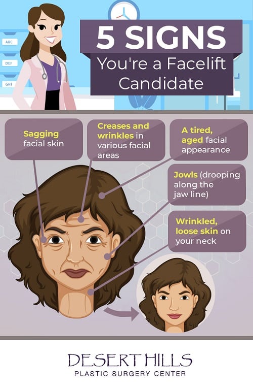 5 signs you are a facelift candidate 6414a2ec6431a