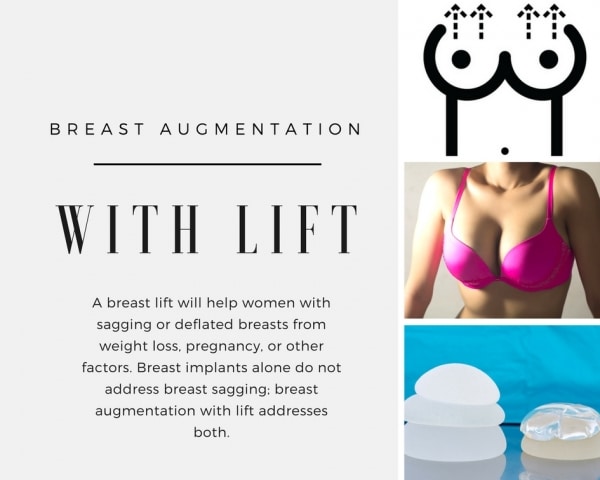Breast Augmentation with Lift 0