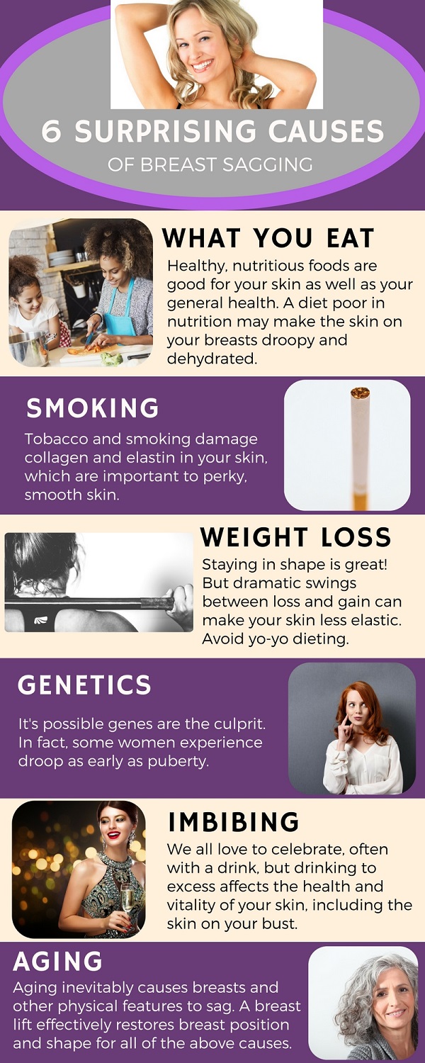 breast sagging info graphic