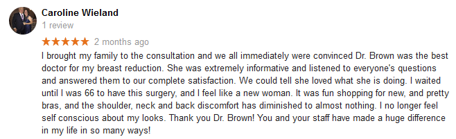 My Breast Reduction (34DDD to B/C) - Review - RealSelf