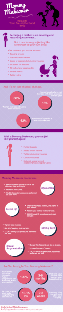 infographic mommy makeover 6414abafbe627