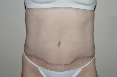 After Image