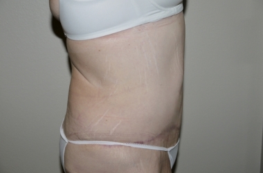 After Image