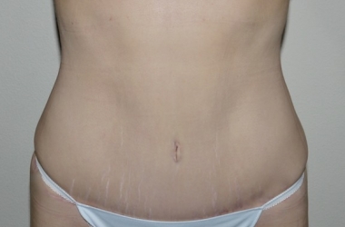 After Image