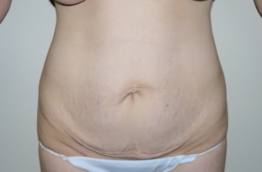 Before Image