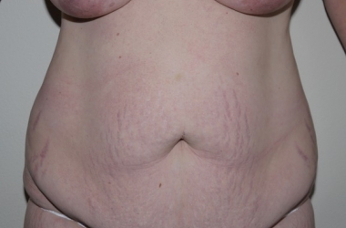 Before Image