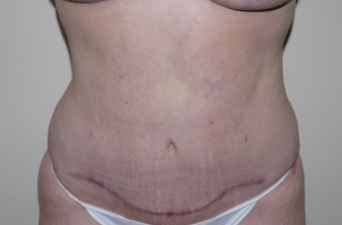After Image