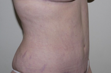 After Image