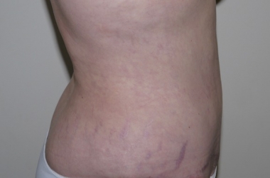 After Image