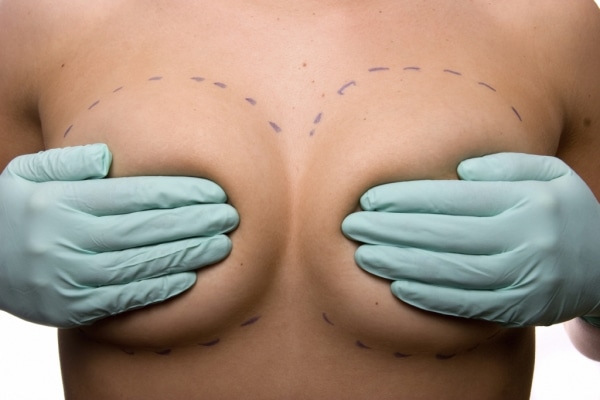 what procedures can a breast surgeon do for me 6414a99f48a1a