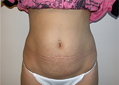Before Image