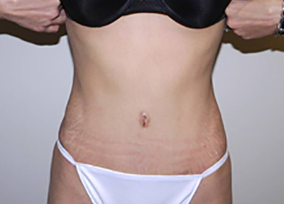 After Image