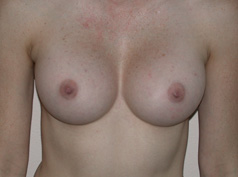 After Image
