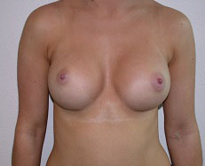 After Image