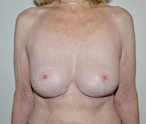 After Image