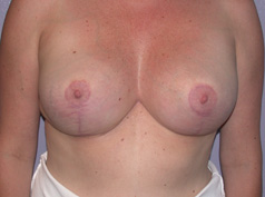 After Image