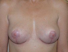 After Image