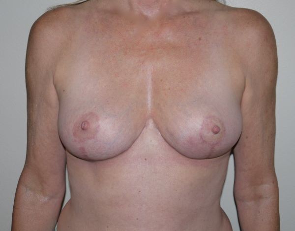 After Image