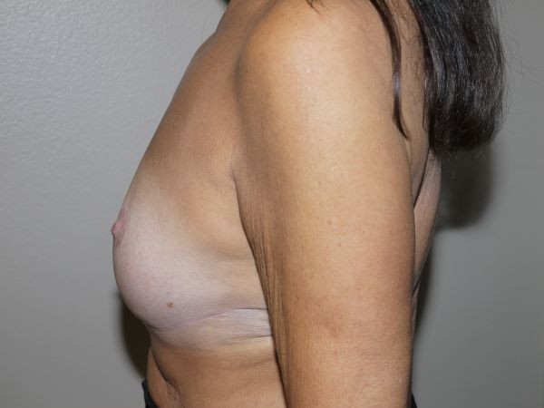 After Image
