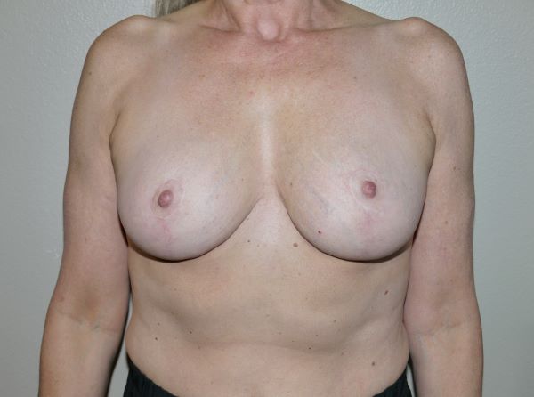 After Image